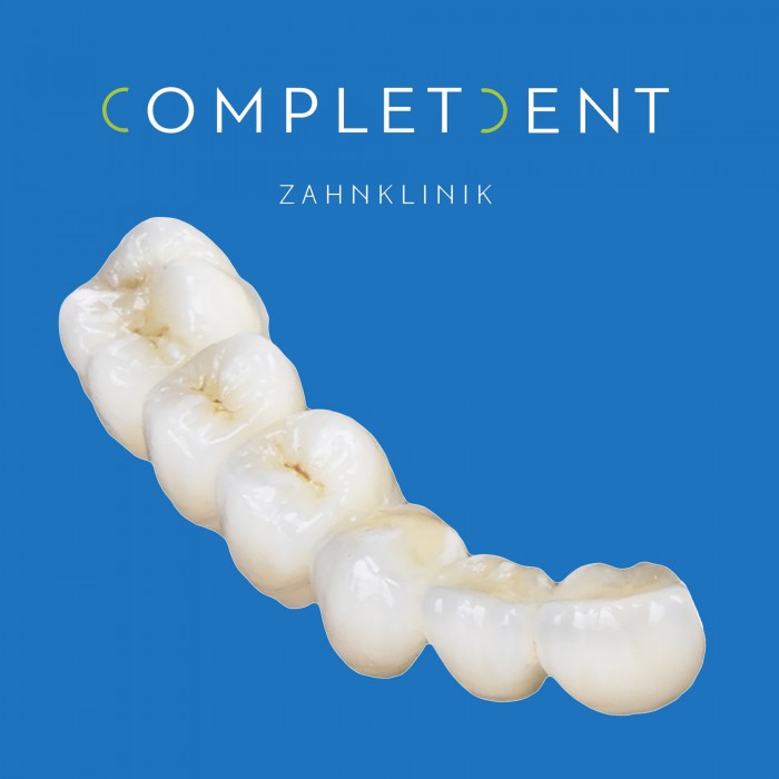 Zahnbrücke Modell der Completdent Zahnklink ©