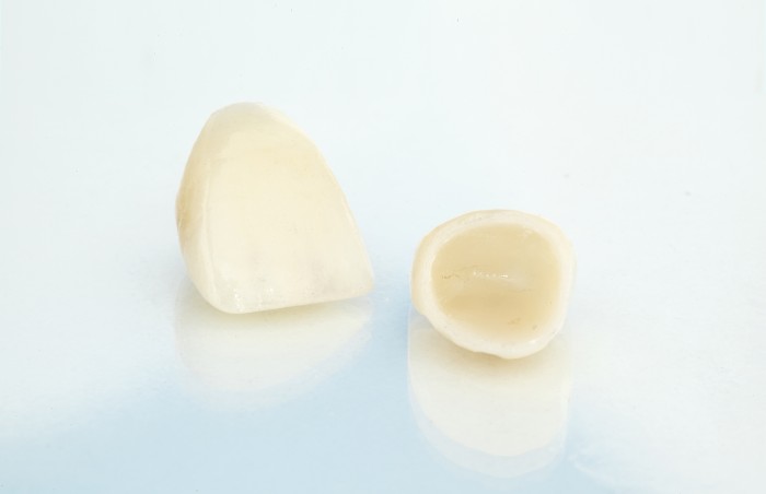 Metallfreie keramische Zahnkronen