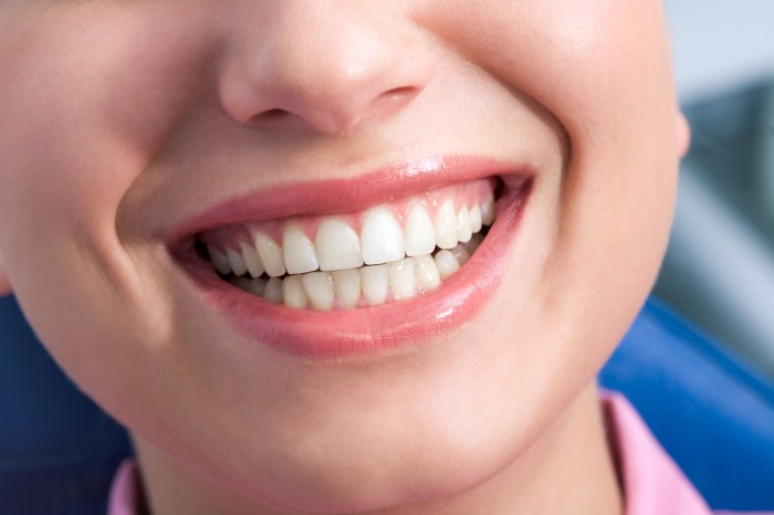 Strahlendes Lächeln mit gesundem Zahnfleisch nach der Parodontosebehandlung