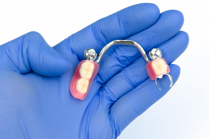 Teilprothese für das Schließen von Zahnlücken